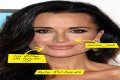 Botox, Implants & More! – Hollywood Life
